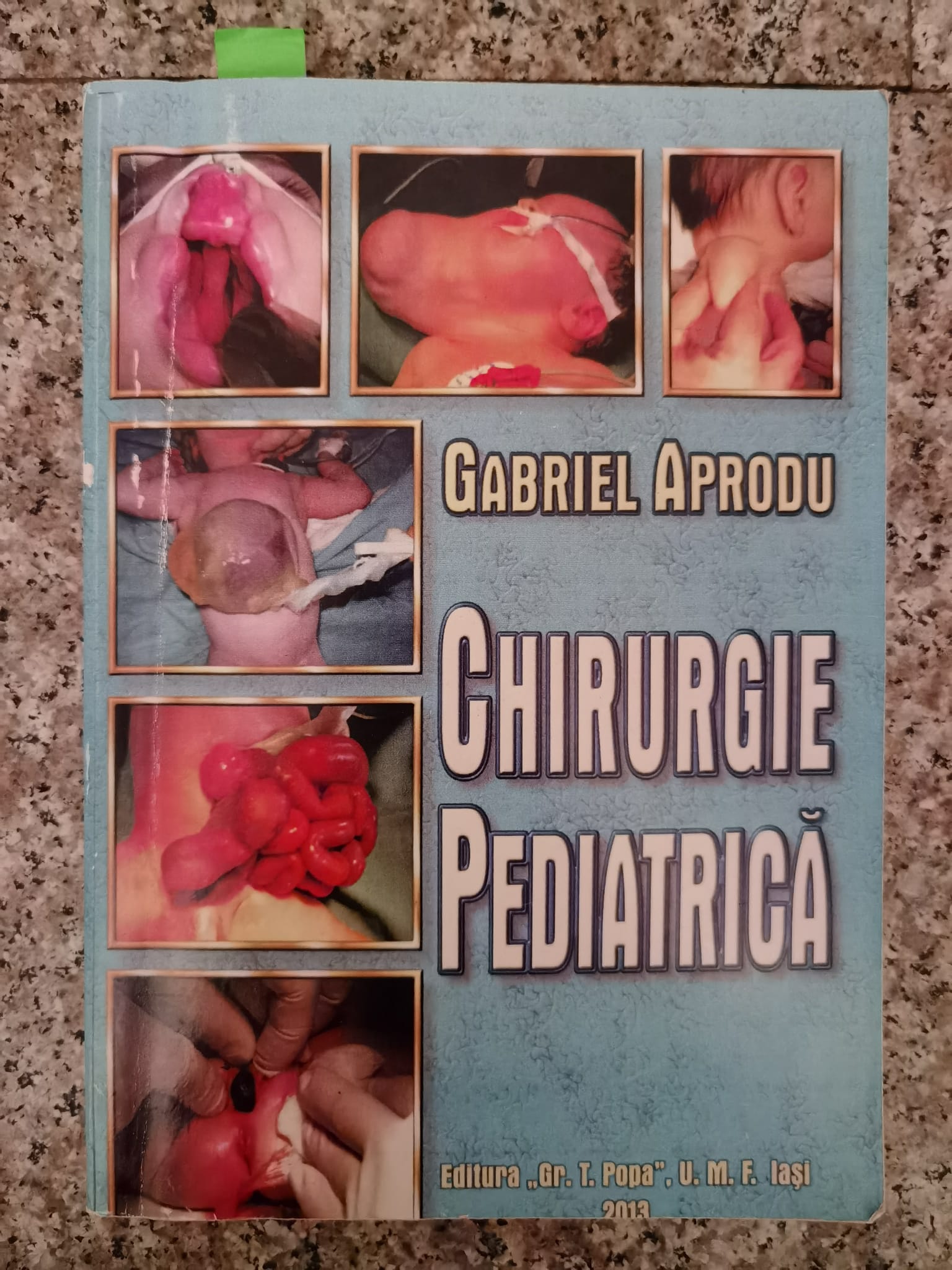 chirurgie pediatrica                                                                                 gabriel aprodu                                                                                      