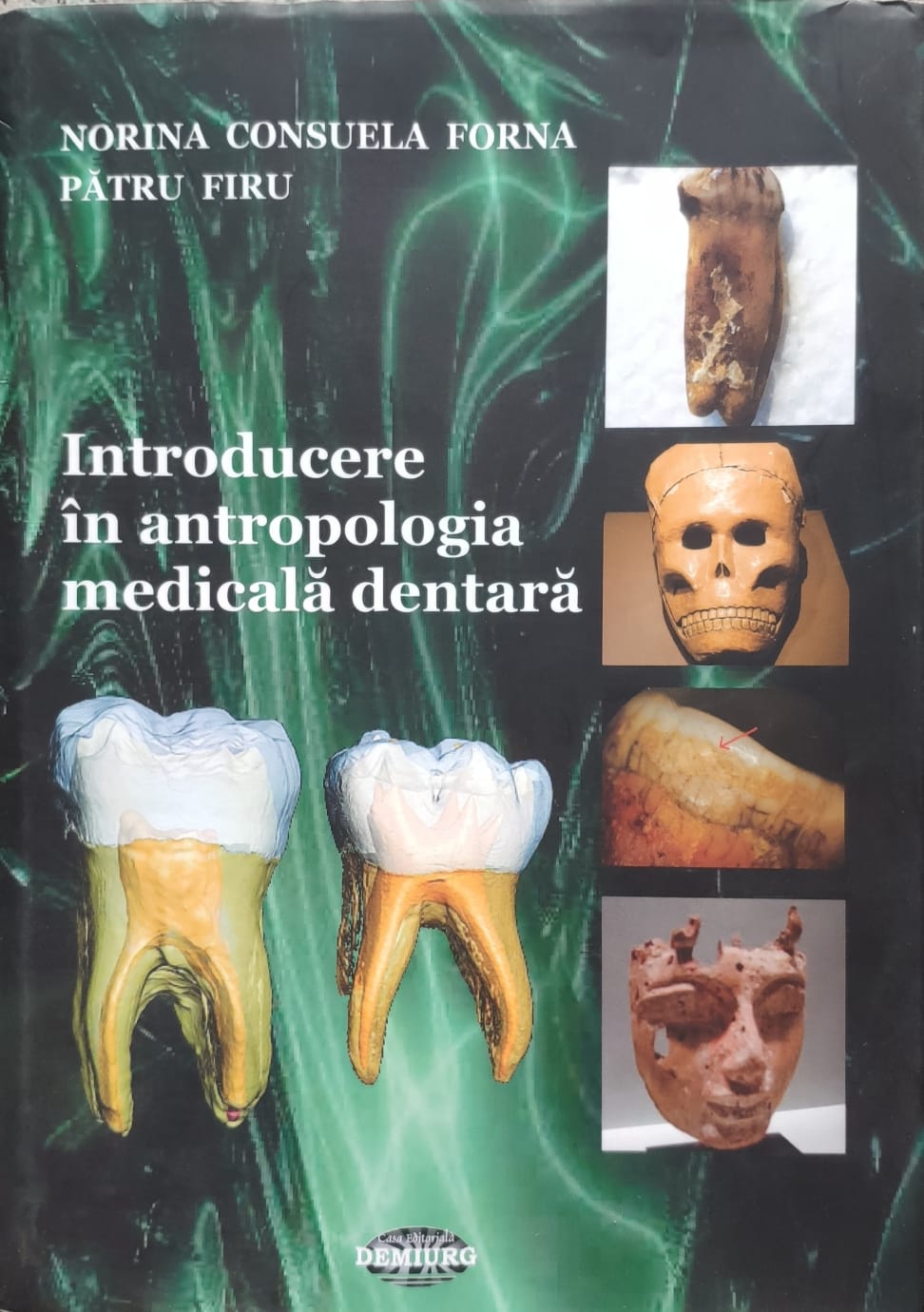 introducere in antropologia medicala dentara                                                         norina consuela forna, patru firu                                                                   