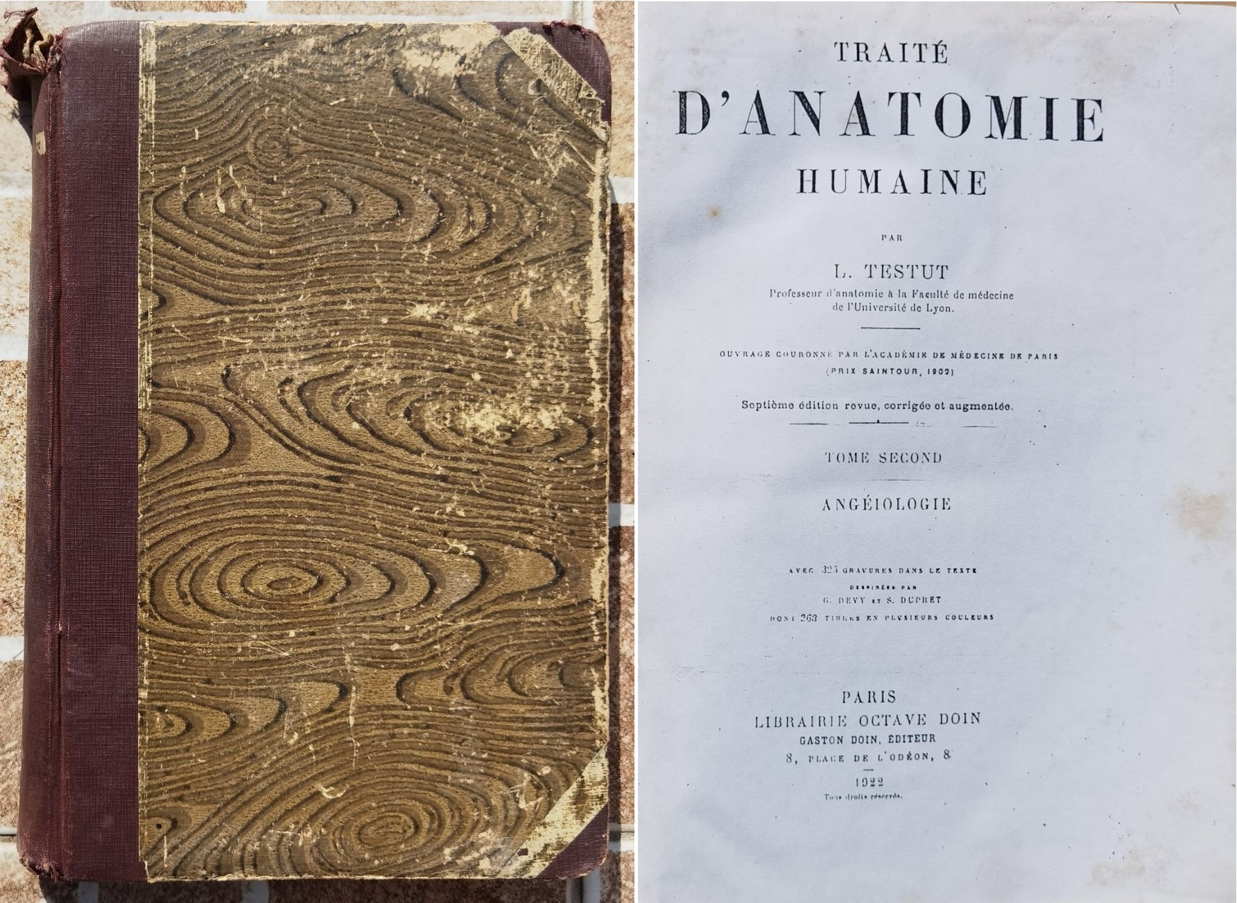 Traite d Anatomie Humaine Vol. 2                                                          ...